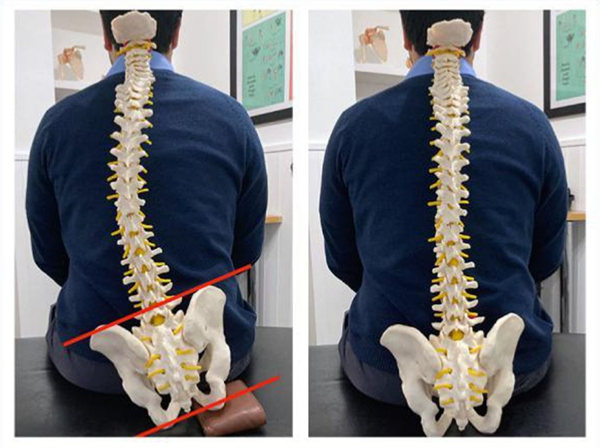 Poor Posture 4