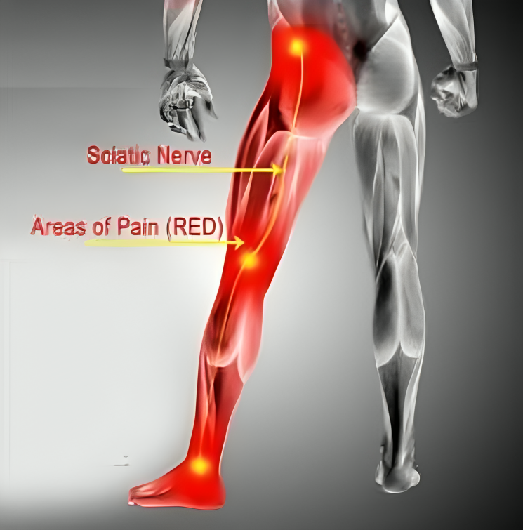 Transcutaneous Electrical Nerve Stimulation